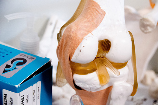model of a knee and its ligaments and tendons